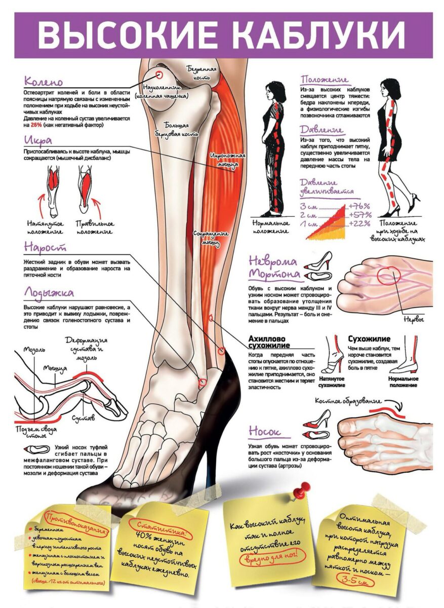 Инфографика медицинская – про каблуки